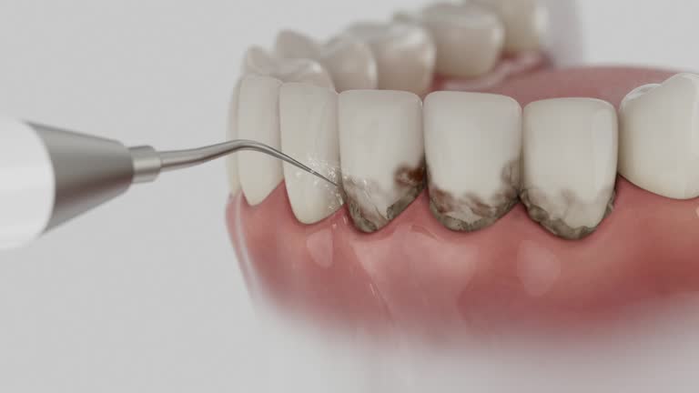 Reliable Teeth Cleaning And Checkup contractor in Lumpkin County County, GA by Dentist Open Now